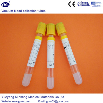 Vakuum-Blutentnahmeröhrchen Sst Tube (ENK-CXG-021)
